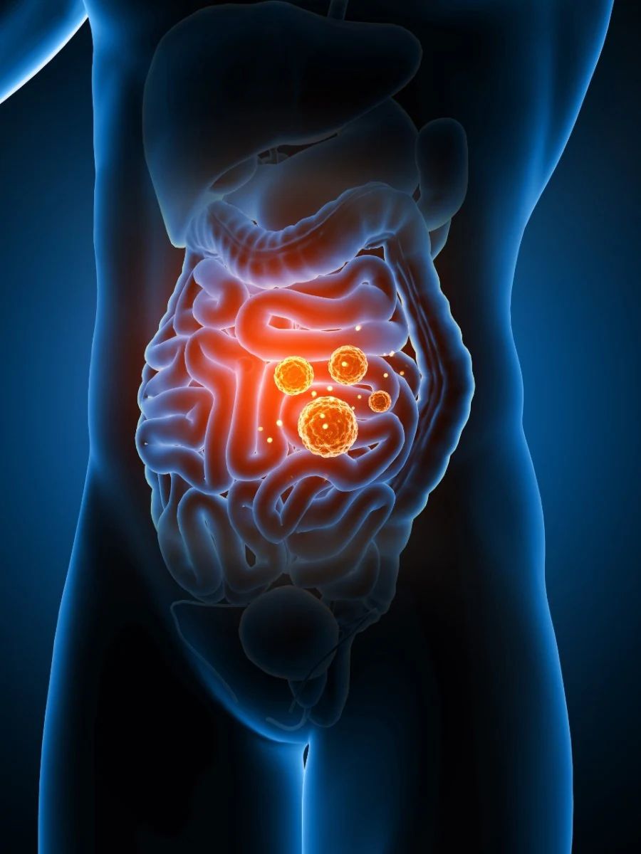 IBS and abdominal pain treatment at Healtree Hospital Neelankarai